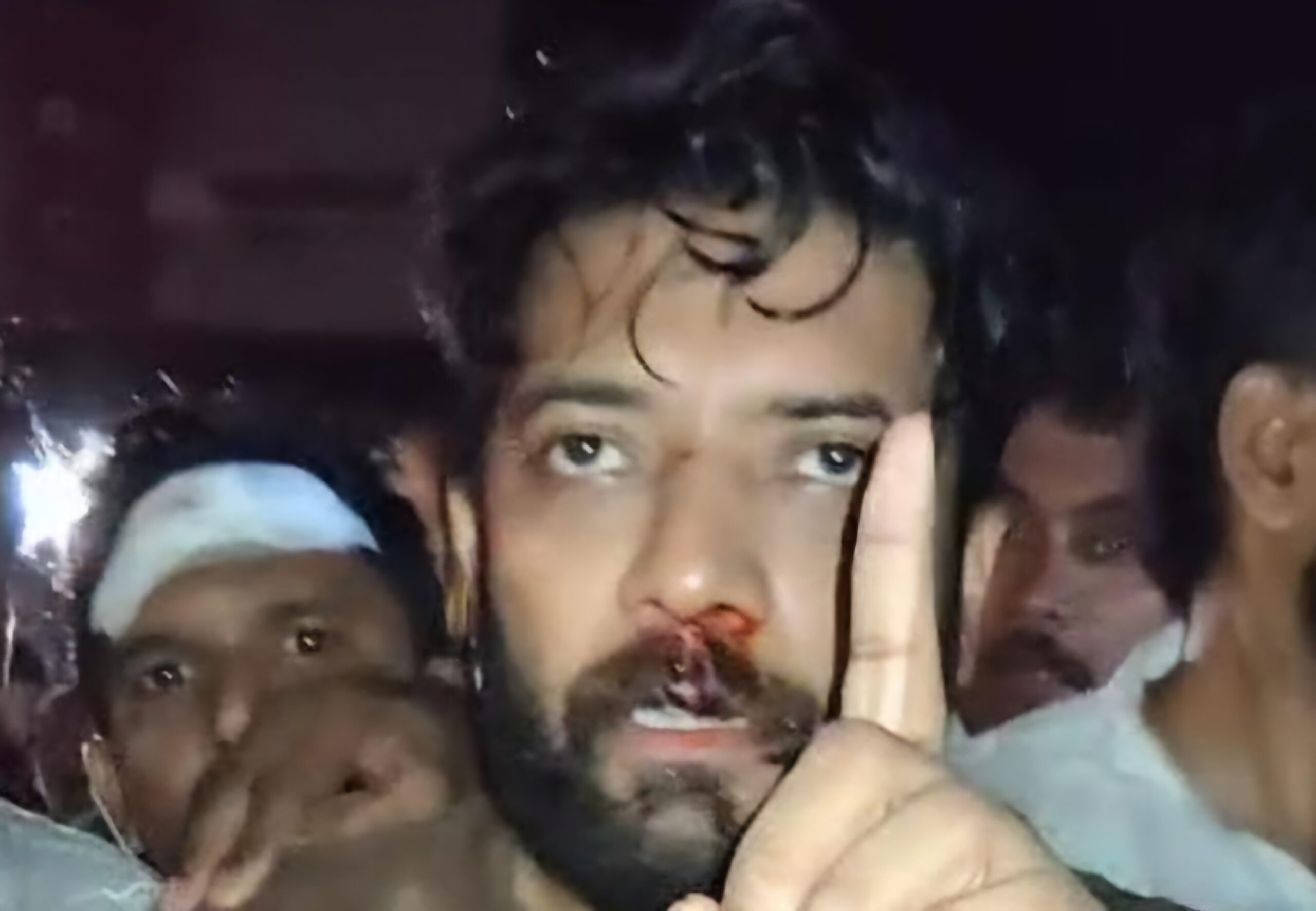 Injured Shafi Parambil MP 